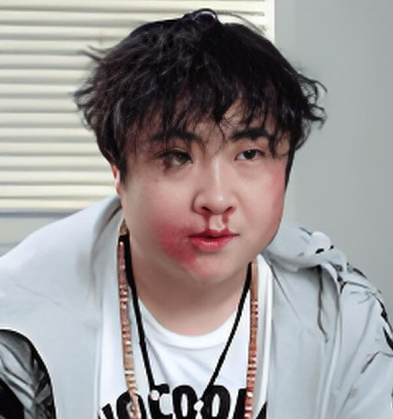 hình ảnh chảy máu mũi